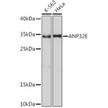 Western Blot - Anti-ANP32E Antibody (A93172) - Antibodies.com