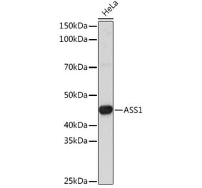 Western Blot - Anti-ASS1 Antibody (A93173) - Antibodies.com