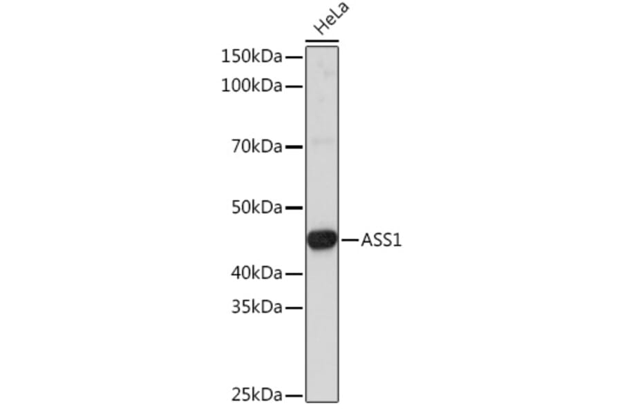Western Blot - Anti-ASS1 Antibody (A93173) - Antibodies.com