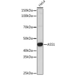 Western Blot - Anti-ASS1 Antibody (A93173) - Antibodies.com