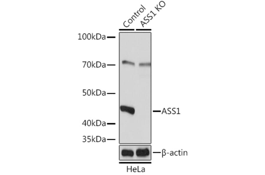 Western Blot - Anti-ASS1 Antibody (A93173) - Antibodies.com