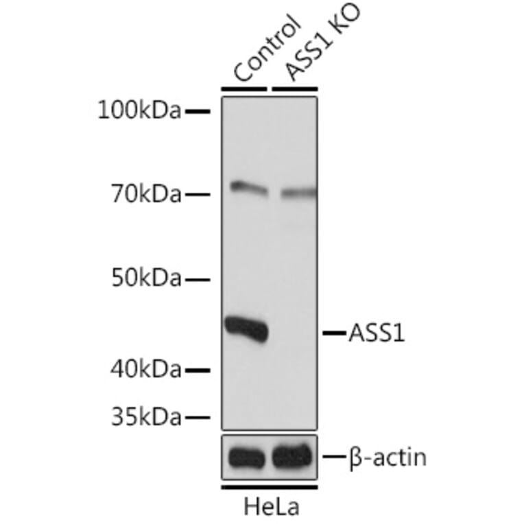 Western Blot - Anti-ASS1 Antibody (A93173) - Antibodies.com