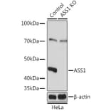 Western Blot - Anti-ASS1 Antibody (A93173) - Antibodies.com