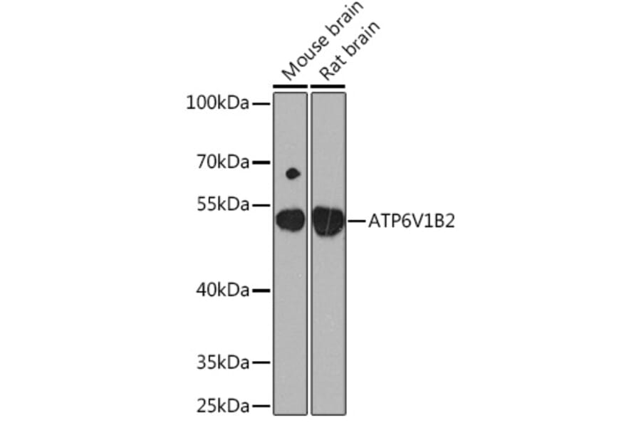 Western Blot - Anti-ATP6V1B2 Antibody (A93175) - Antibodies.com
