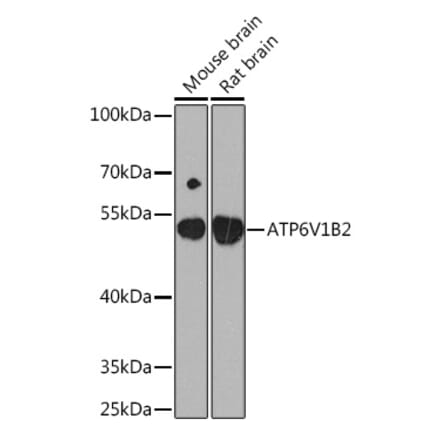 Western Blot - Anti-ATP6V1B2 Antibody (A93175) - Antibodies.com