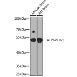 Western Blot - Anti-ATP6V1B2 Antibody (A93175) - Antibodies.com