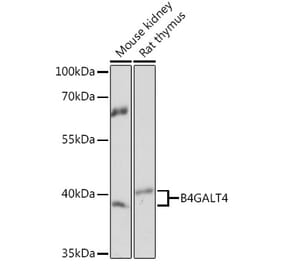 Western Blot - Anti-B4GALT4 Antibody (A93178) - Antibodies.com