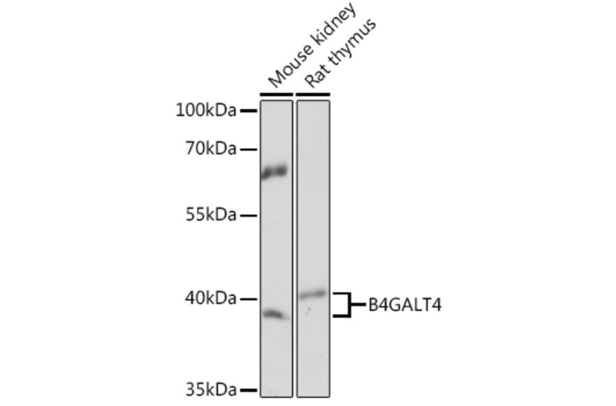 Western Blot - Anti-B4GALT4 Antibody (A93178) - Antibodies.com