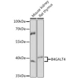 Western Blot - Anti-B4GALT4 Antibody (A93178) - Antibodies.com