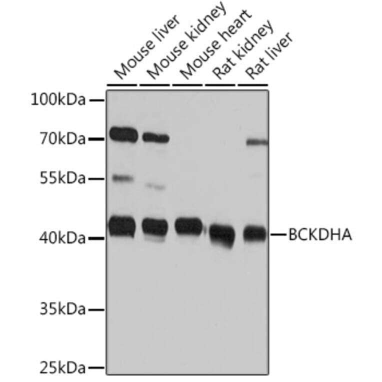 Western Blot - Anti-BCKDHA Antibody (A93179) - Antibodies.com