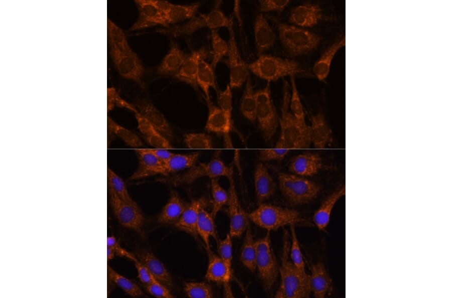 Immunofluorescence - Anti-Peregrin/BRPF1 Antibody (A93180) - Antibodies.com