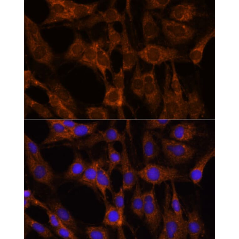 Immunofluorescence - Anti-Peregrin/BRPF1 Antibody (A93180) - Antibodies.com