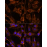 Immunofluorescence - Anti-Peregrin/BRPF1 Antibody (A93180) - Antibodies.com