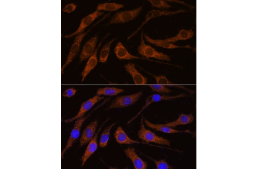Immunofluorescence - Anti-Peregrin/BRPF1 Antibody (A93180) - Antibodies.com