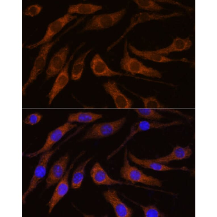 Immunofluorescence - Anti-Peregrin/BRPF1 Antibody (A93180) - Antibodies.com