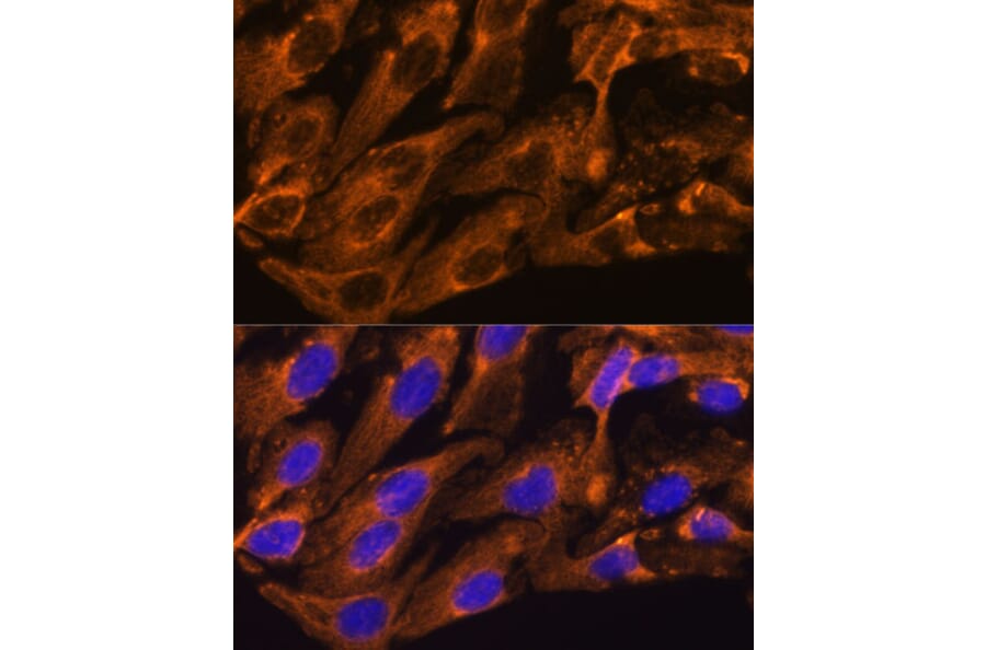 Immunofluorescence - Anti-Peregrin/BRPF1 Antibody (A93180) - Antibodies.com