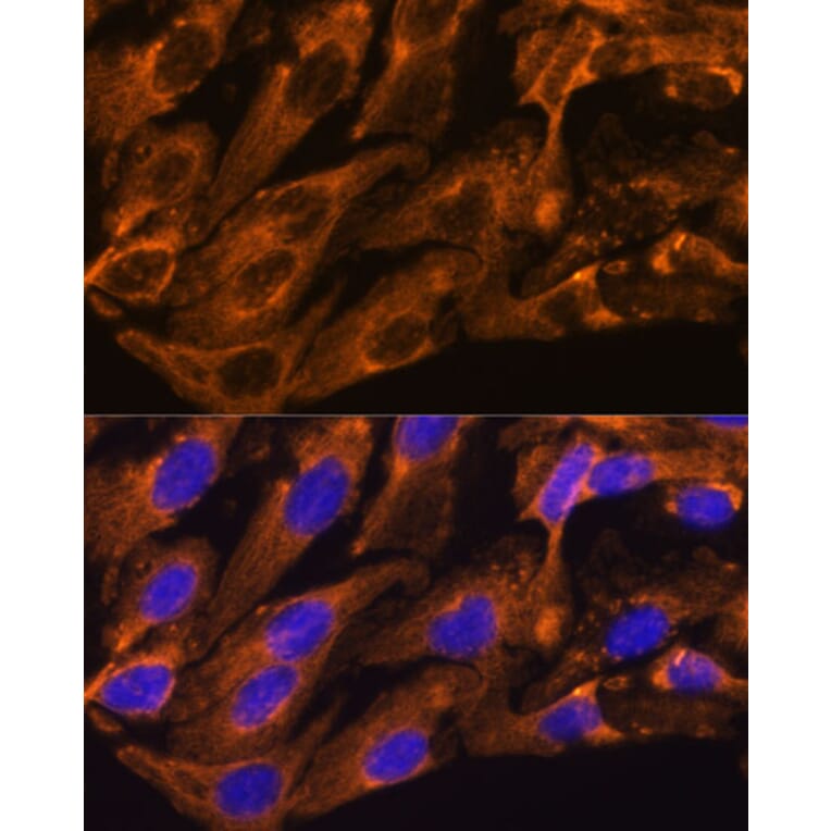 Immunofluorescence - Anti-Peregrin/BRPF1 Antibody (A93180) - Antibodies.com