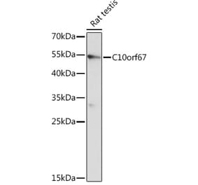 Western Blot - Anti-C10orf67 Antibody (A93181) - Antibodies.com