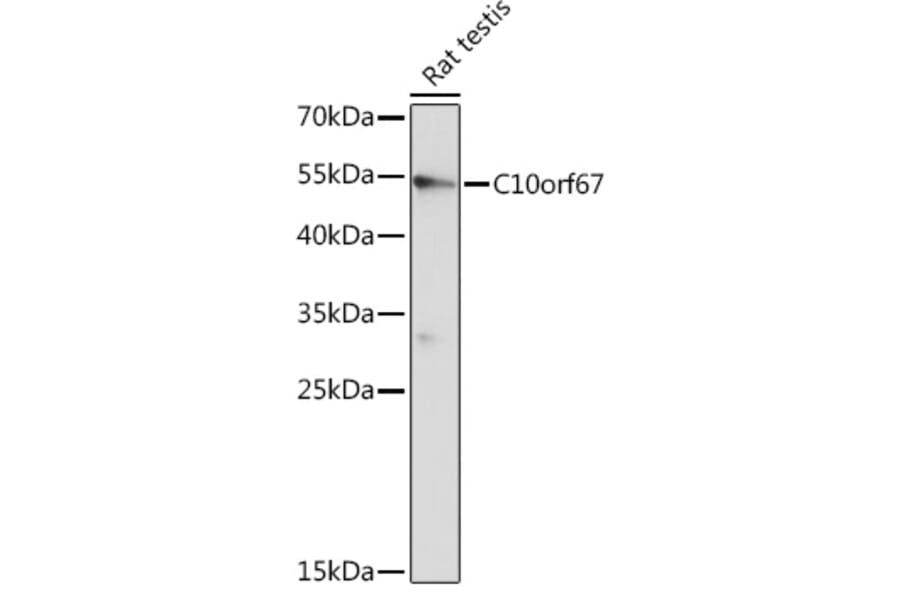 Western Blot - Anti-C10orf67 Antibody (A93181) - Antibodies.com
