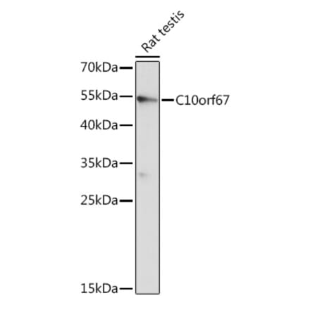Western Blot - Anti-C10orf67 Antibody (A93181) - Antibodies.com