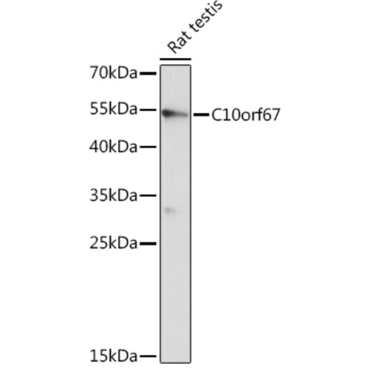 Western Blot - Anti-C10orf67 Antibody (A93181) - Antibodies.com