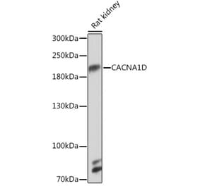 Western Blot - Anti-CaV1.3 Antibody (A93183) - Antibodies.com