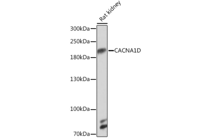 Western Blot - Anti-CaV1.3 Antibody (A93183) - Antibodies.com