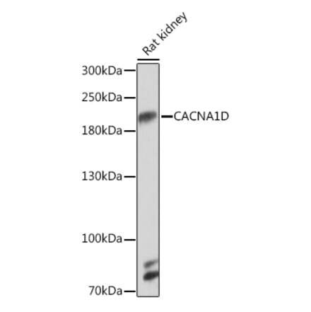 Western Blot - Anti-CaV1.3 Antibody (A93183) - Antibodies.com