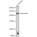 Western Blot - Anti-CaV1.3 Antibody (A93183) - Antibodies.com