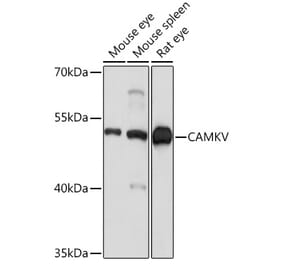 Western Blot - Anti-CAMKV Antibody (A93184) - Antibodies.com