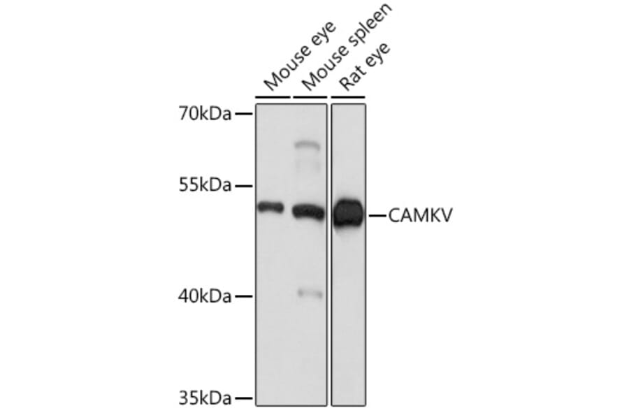 Western Blot - Anti-CAMKV Antibody (A93184) - Antibodies.com