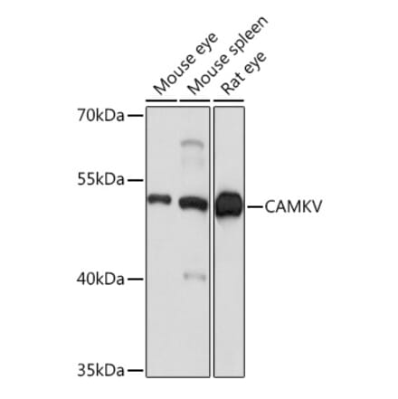 Western Blot - Anti-CAMKV Antibody (A93184) - Antibodies.com