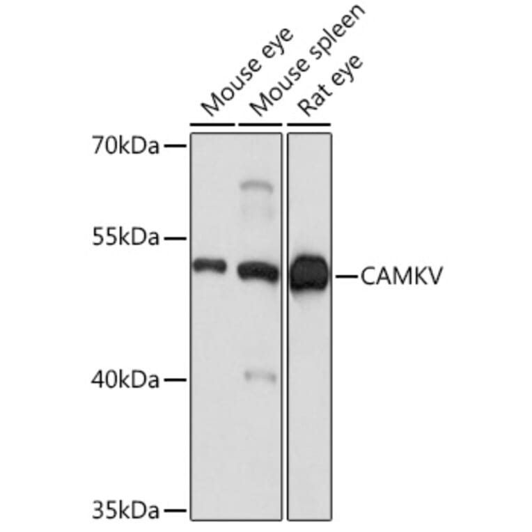 Western Blot - Anti-CAMKV Antibody (A93184) - Antibodies.com