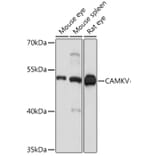 Western Blot - Anti-CAMKV Antibody (A93184) - Antibodies.com