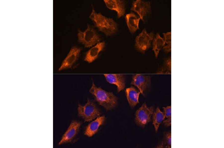 Immunofluorescence - Anti-CAMKV Antibody (A93184) - Antibodies.com