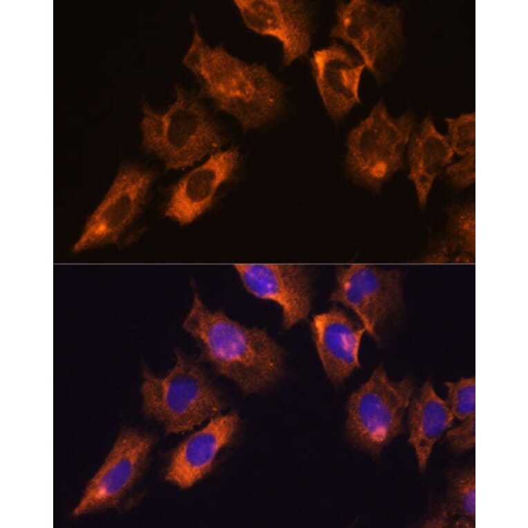 Immunofluorescence - Anti-CAMKV Antibody (A93184) - Antibodies.com