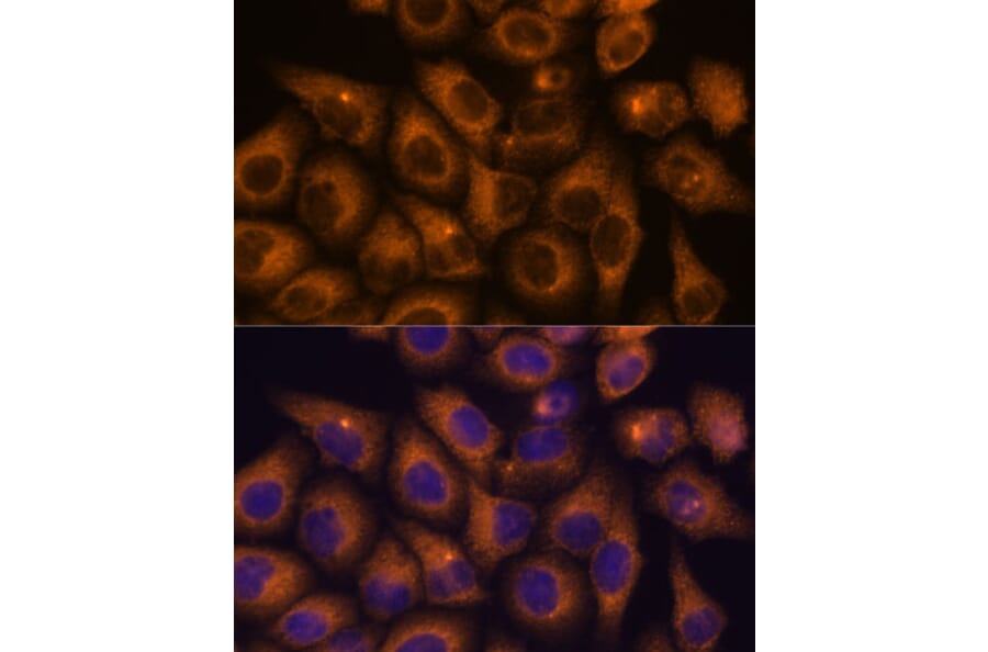 Immunofluorescence - Anti-CAMKV Antibody (A93184) - Antibodies.com