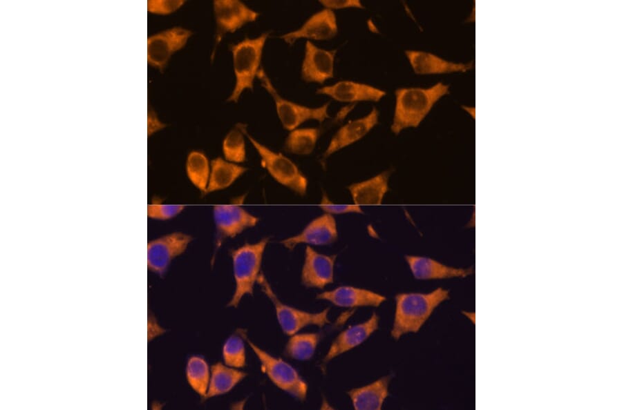 Immunofluorescence - Anti-CAMKV Antibody (A93184) - Antibodies.com
