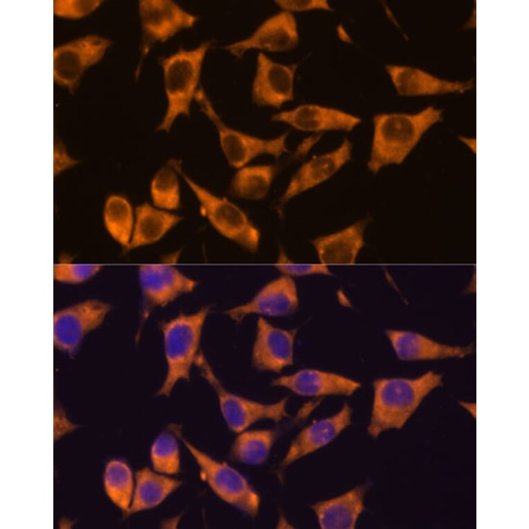 Immunofluorescence - Anti-CAMKV Antibody (A93184) - Antibodies.com