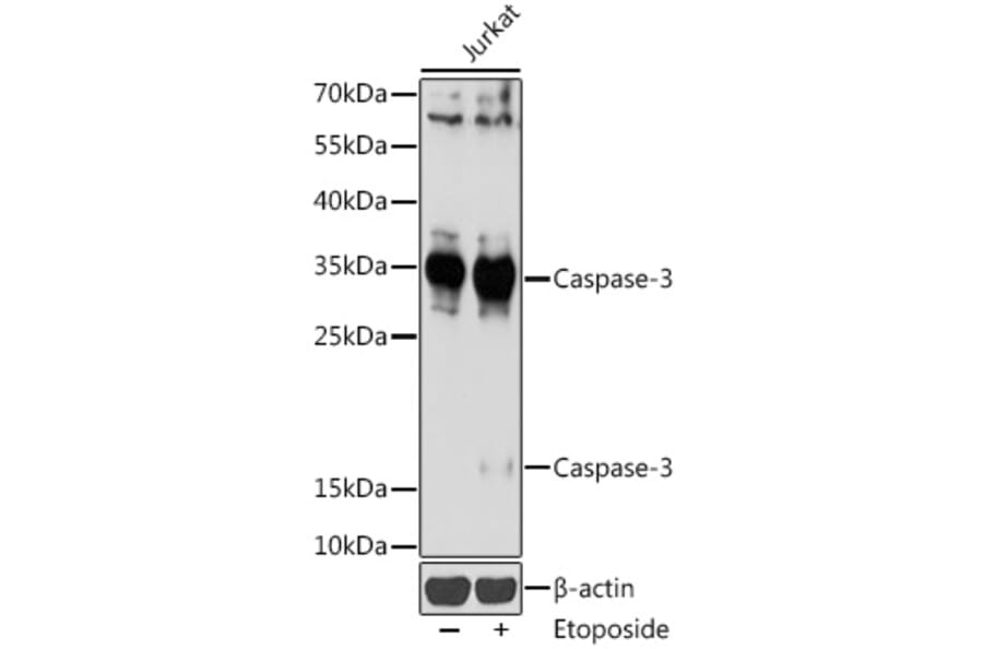 Western Blot - Anti-Caspase-3 Antibody (A93186) - Antibodies.com