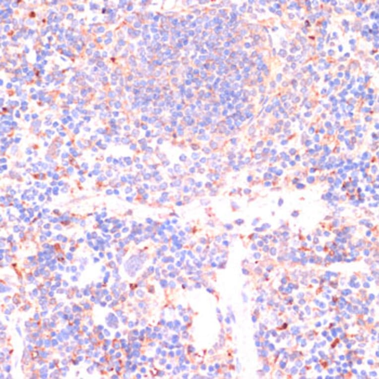 Immunohistochemistry - Anti-Caspase-3 Antibody (A93186) - Antibodies.com