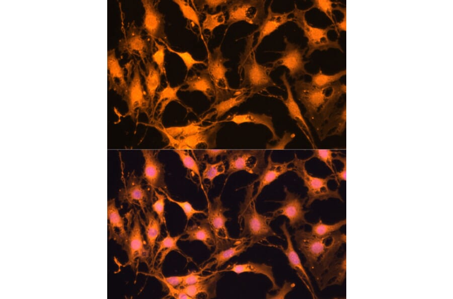 Immunofluorescence - Anti-Caspase-3 Antibody (A93186) - Antibodies.com