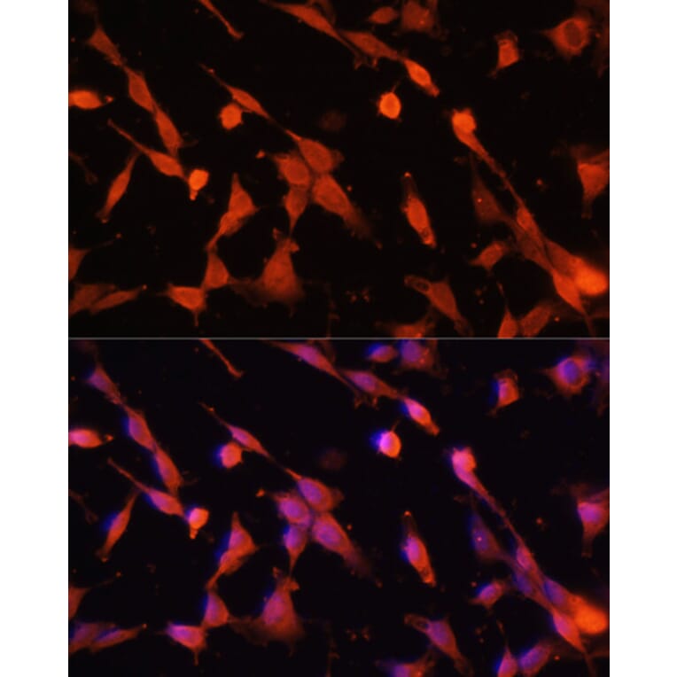 Immunofluorescence - Anti-Caspase-3 Antibody (A93186) - Antibodies.com