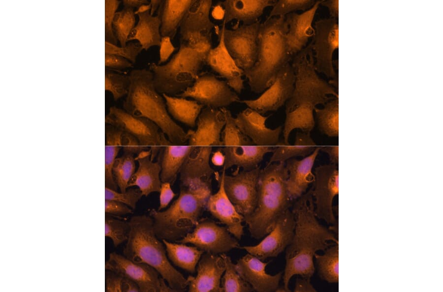 Immunofluorescence - Anti-Caspase-3 Antibody (A93186) - Antibodies.com