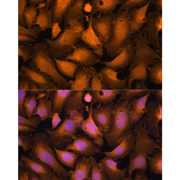 Immunofluorescence - Anti-Caspase-3 Antibody (A93186) - Antibodies.com