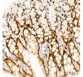 Immunohistochemistry - Anti-CDX2 Antibody (A93194) - Antibodies.com