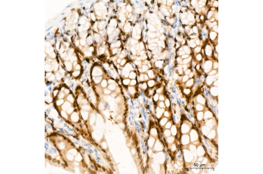 Immunohistochemistry - Anti-CDX2 Antibody (A93194) - Antibodies.com