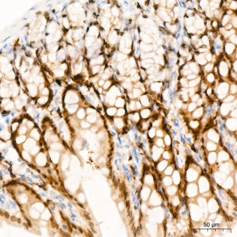 Immunohistochemistry - Anti-CDX2 Antibody (A93194) - Antibodies.com