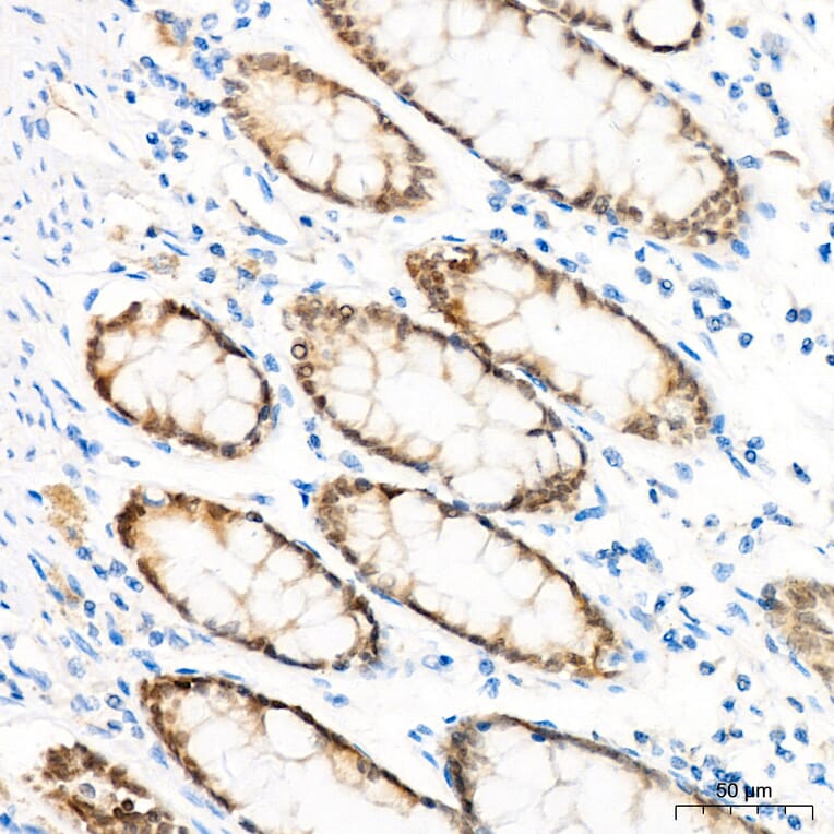 Immunohistochemistry - Anti-CDX2 Antibody (A93194) - Antibodies.com