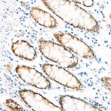 Immunohistochemistry - Anti-CDX2 Antibody (A93194) - Antibodies.com